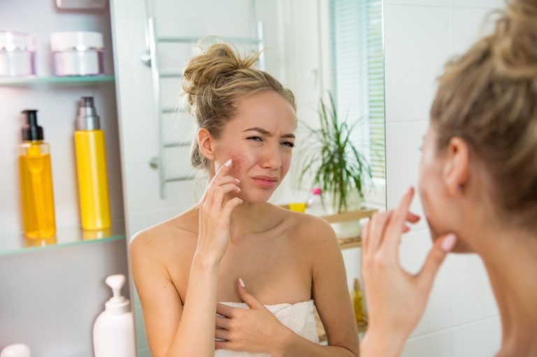 What’s Acne And How It Happens